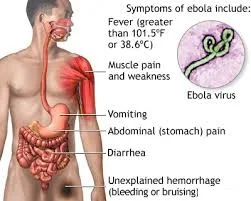 Infographics on Ebola virus