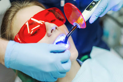 Laser Dentistry Hyderabad