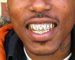 Teeth Grills (Gold Grillz)