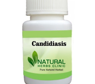 Herbal Product for Candidiasis