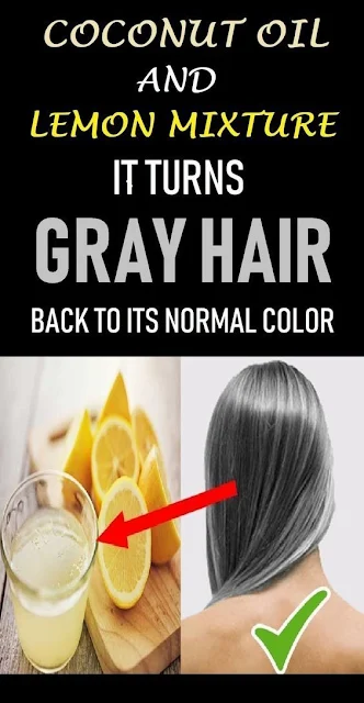 Home Remedy: Coconut Oil And Lemon Mixture Will Turns Gray Hair Back To Its Natural Color