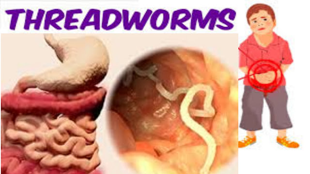 threadworm adult treatments (2022-23),threadworm medicine, threadworm adult treatments (2022-23),threadworm medicine,Best threadworm medicine,what are the best threadworm medicine,threadworm,what is threadworm