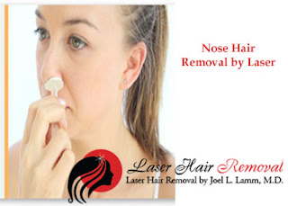 nose laser hair removal