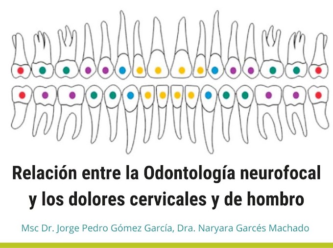 PDF: Relación entre la Odontología Neurofocal y los dolores cervicales y de hombro