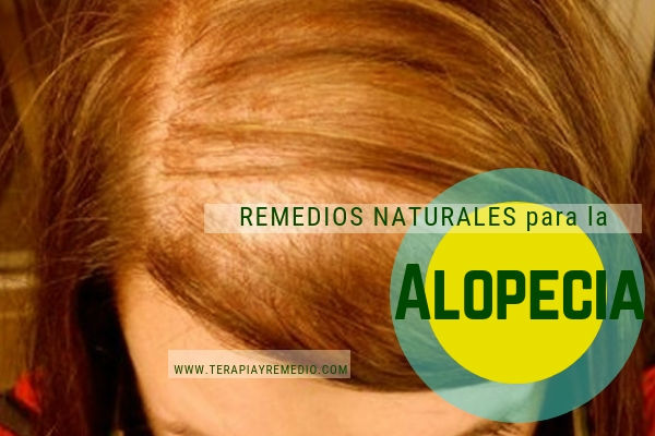 Remedios naturales para la alopecia, tratamiento natural para la caída del cabello