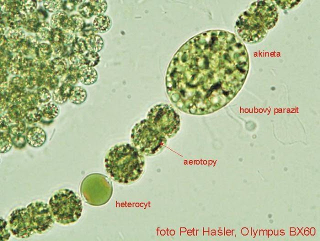 Akinet Adalah - Kamus Biologi Online