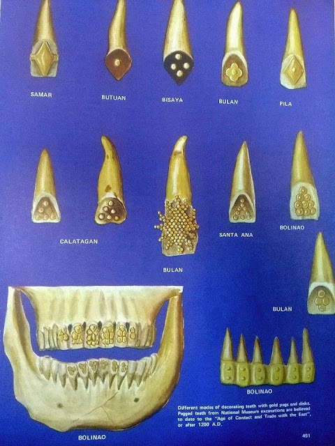 Инкрустированные золотом зубы черепа Болинао