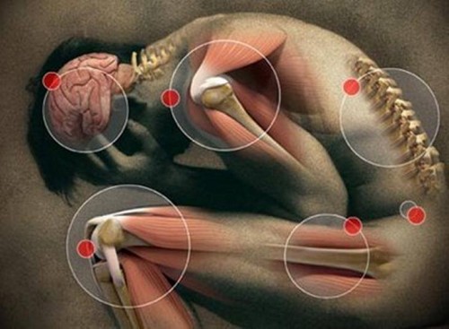 propiedades anti-inflamatorias de la cúrcuma