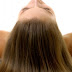 Top 10 Itchy Scalp Causes