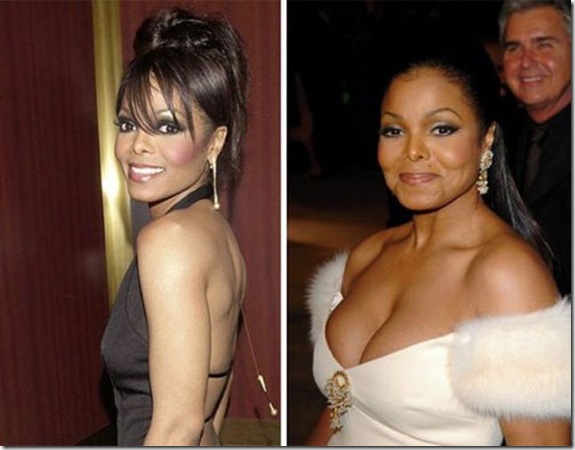 celebrity-fake-boobs-fe2534