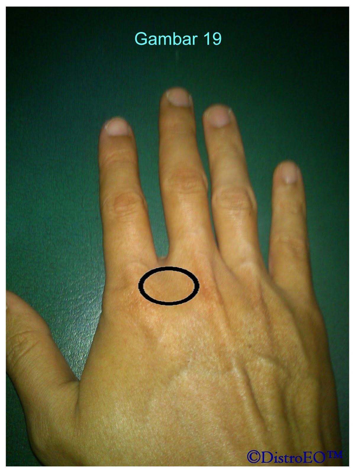 Titik Telapak Tangan 3T dan manfaatnya Orgonite 3T Titik Telapak Tangan 3T dan manfaatnya Orgonite 3T