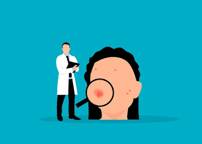 Understanding Acne: Causes, Symptoms, and Treatment Options
