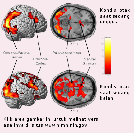 Otak manusia saat menjadi atasan dan bawahan