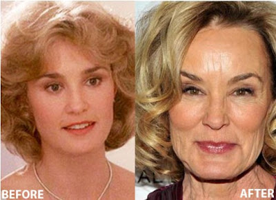 Jessica Lange Plastic Surgery Before