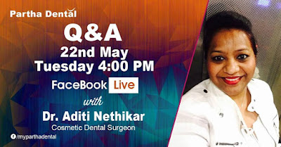 Partha Dental Facebook Live with Dr. Aditi Nethikar, Cosmetic Dental Surgeon on 22nd May at 04:00 PM.