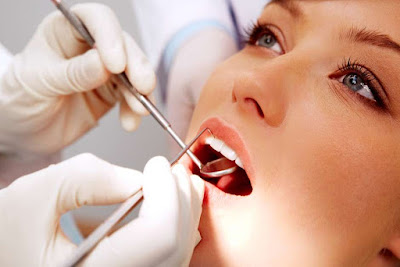 ¿Por qué podría necesitar un tratamiento de endodoncia?