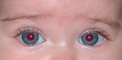 Fotografía bebe con ojos rojos