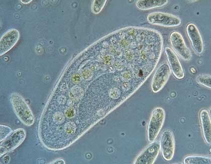 6 Macam Filum Protozoa Protista Mirip Hewan Gambar  