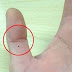 Các nốt ruồi trên ngón tay nói gì về bạn?