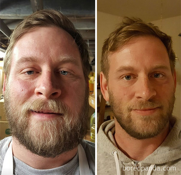 10+ Before-And-After Pics Show What Happens When You Stop Drinking - 7 Months Sober