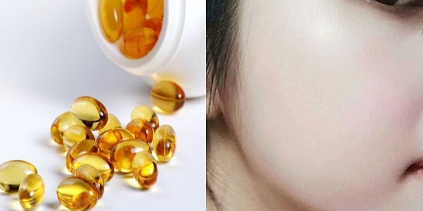 Phương pháp điều trị sẹo thâm hiệu quả nhanh chóng từ Vitamin E