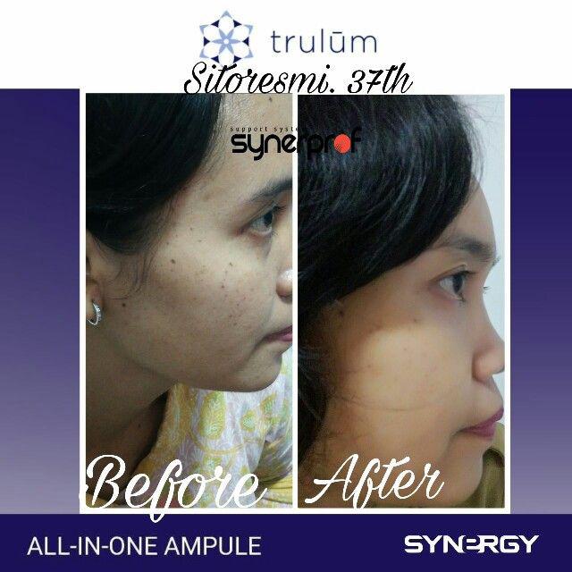 Jual Trulum All In One Ampoule Di Area Dumoga Barat, Bolaang Mongondow WA: 08112338376