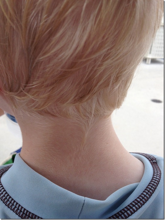 olliehair