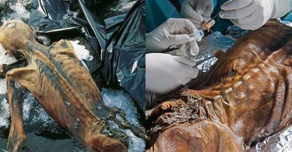 Otzi (Manusia Es) Membeku Selama 5300 Tahun, Ada Apa Didalam Tubuhnya..?