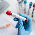 Número de casos de idosos com HIV quadruplica em uma década no Brasil
