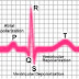 Cara Membaca Hasil EKG