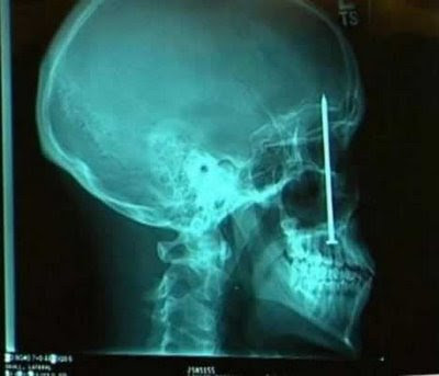 Unbelievable X-rays (12) 2