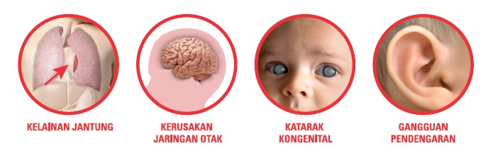 :: Klinik Anak Zhazha Palembang :: dr Prakanita SpA
