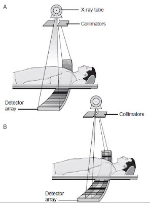 detector