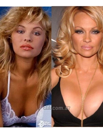 Pamella Anderson