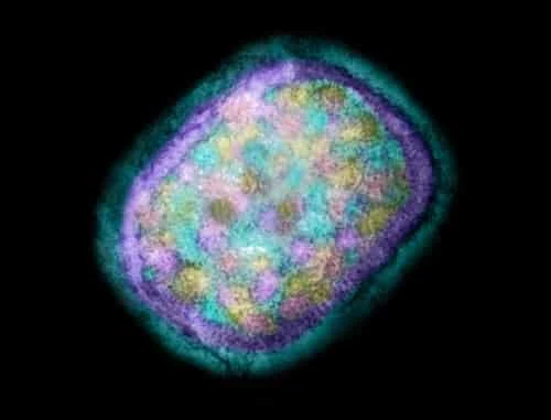 Monkeypox Virus, TEM Micrografia Eletrônica de Transmissão (TEM) com coloração negativa demonstrando o vírus da varíola dos macacos em uma cultura de células.