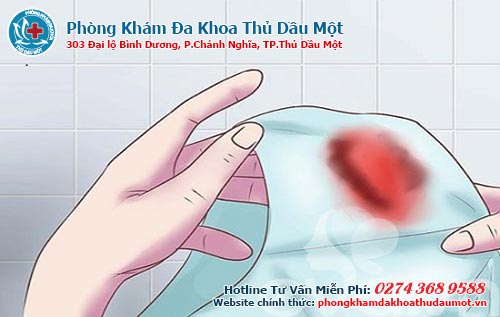 Cách chữa đi cầu ra máu đỏ tươi đúng cách