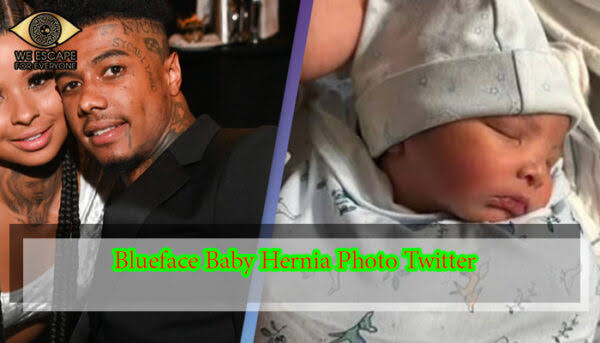 Watch Blueface son hernia photo
