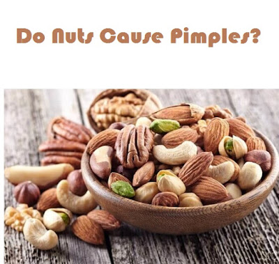 Do groundnuts cause pimples?