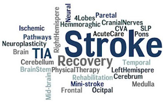 Obat Stroke Perdarahan, Terapi Pengobatan Stroke Hemoragik, Foto Penyakit Stroke, Jurnal Penyakit Stroke Iskemik, Mengobati Stroke Dengan Cara Alami, Cara Mengobati Stroke Ringan Secara Alami, Cara Menyembuhkan Penyakit Stroke Dengan Cepat, Obat Untuk Penyakit Stroke Ringan, Obat Alami Sakit Stroke Ringan, Pengobatan Untuk Stroke Ringan, Stroke Karena Penyakit Jantung, Cara Mengobati Stroke Akibat Diabetes, Ciri Penyakit Stroke Ringan, Pengobatan Stroke Mati Sebelah, Penyakit Stroke Ppt, Pengertian Penyakit Stroke Hemoragik, Cara Menyembuhkan Stroke Dengan Herbal, Sap Penyakit Stroke, Obat Untuk Stroke Mata, Obat Stroke Yg Paling Ampuh, Penyakit Stroke Merupakan, Jurnal Penyakit Stroke Pdf, Penyakit Stroke Batang Otak, Obat Paling Ampuh Untuk Penyakit Stroke, Pengobatan Stroke Parah, Obat Stroke Menurut Islam, Cara Mengobati Penyakit Gejala Stroke, Obat Alami Buat Penyakit Stroke, Obat Stroke Alternatif, Usia Penyakit Stroke  