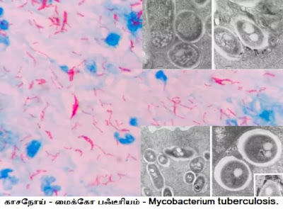 Mycobacterium