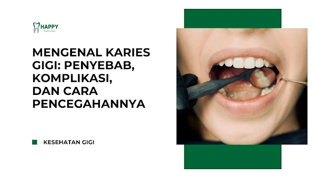 Mengenal Karies Gigi, Penyebab, Komplikasi, dan Cara Pencegahannya