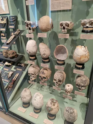 Det indsamlede menneskeの頭蓋骨展示
