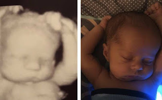 Amazing photos show 3-week-old baby sleeping in same position as he did in the womb