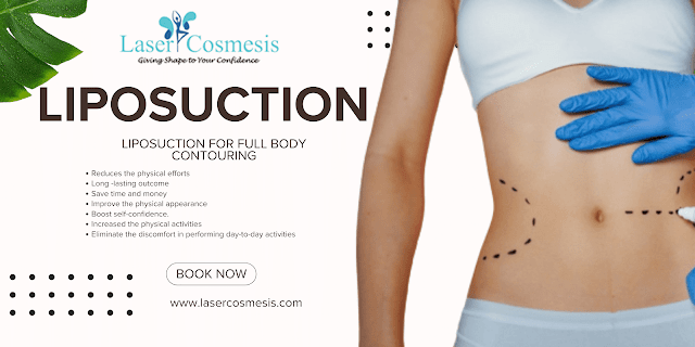 liposuction surgery in Mumbai