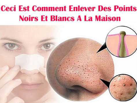 http://www.maigrirastuces.com/2015/08/ceci-est-comment-enlever-des-points.html