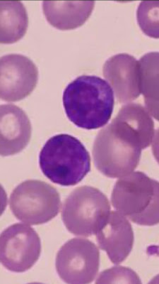 Imagen de un Linfocito - Valores Normales de Leucocitos