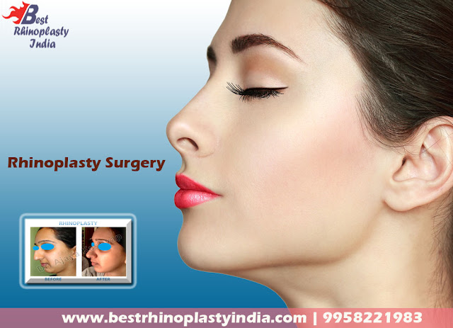 #rhinoplasty ,#rhinoplastycost, #rhinoplastyclinic, #nosesurgeon ,#nosejob, #bestnosesurgeon, #bestrhinoplastyindia, #nosereconstruction