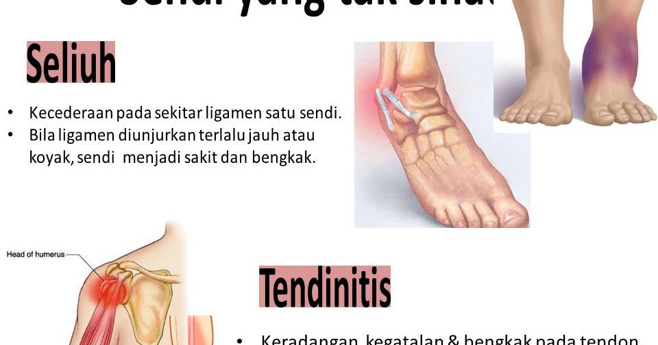 Apa Ubat Kaki Bengkak - Rawatan l