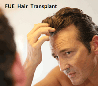 Hair Transplant