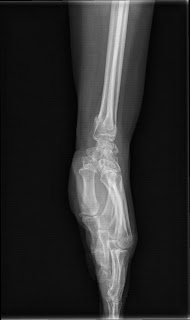 x ray wrist joint